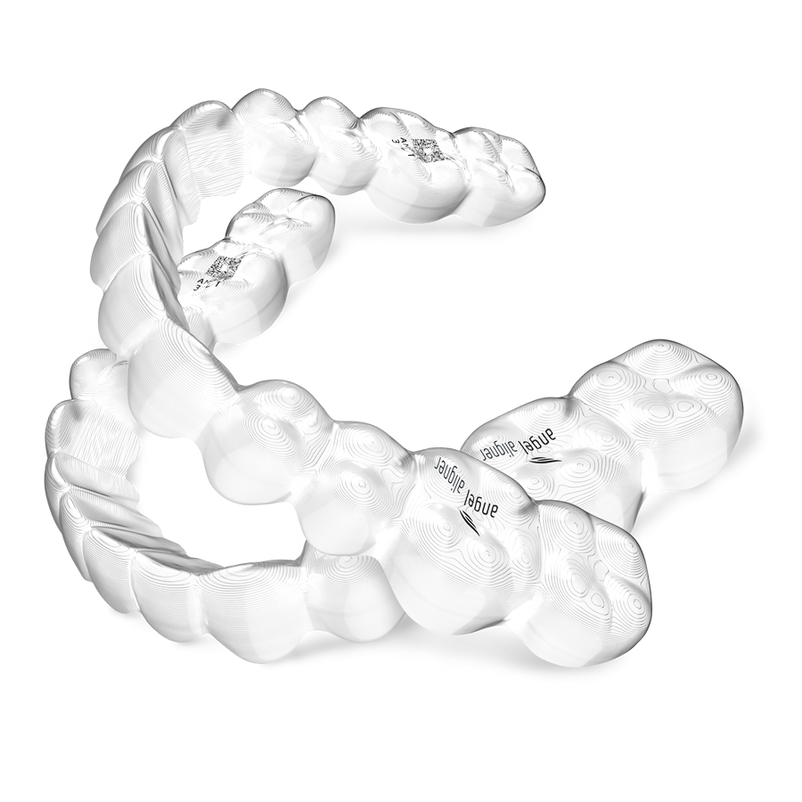 Aligner 3